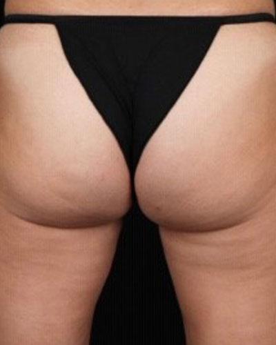 4-5_BA-profound_privetB-2