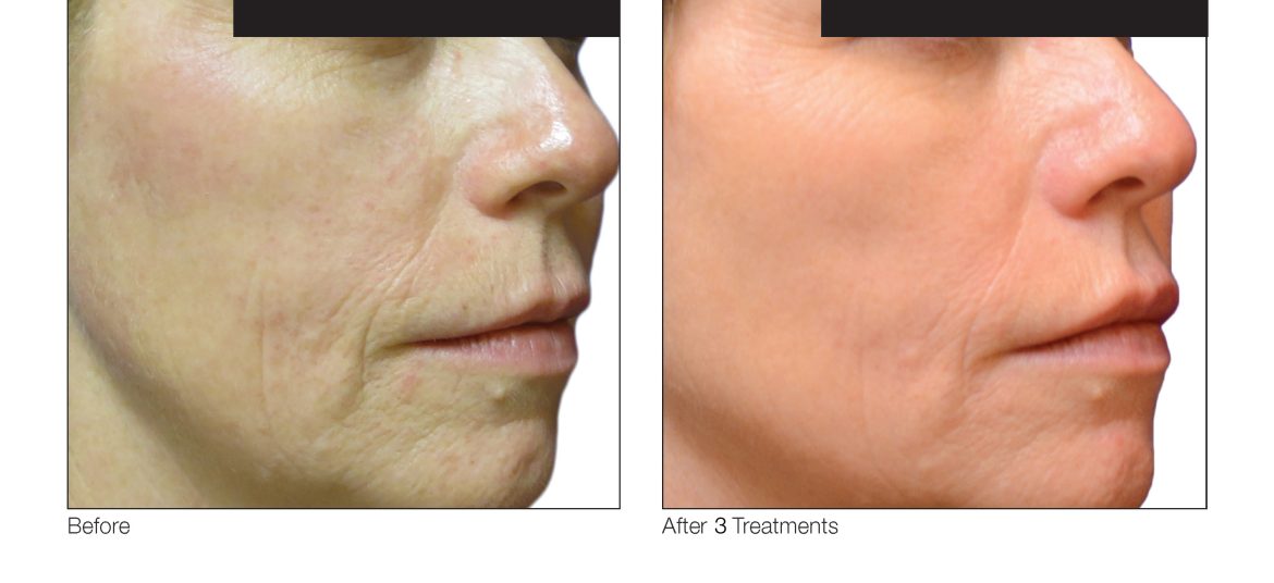 VenusViva_AlexanderCadoux_Face_3Tx_1