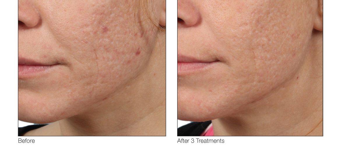 VenusViva_SuzanneYee_Face_3Tx_1