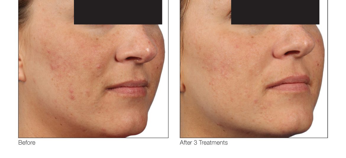 VenusViva_SuzanneYee_Face_3Tx_2