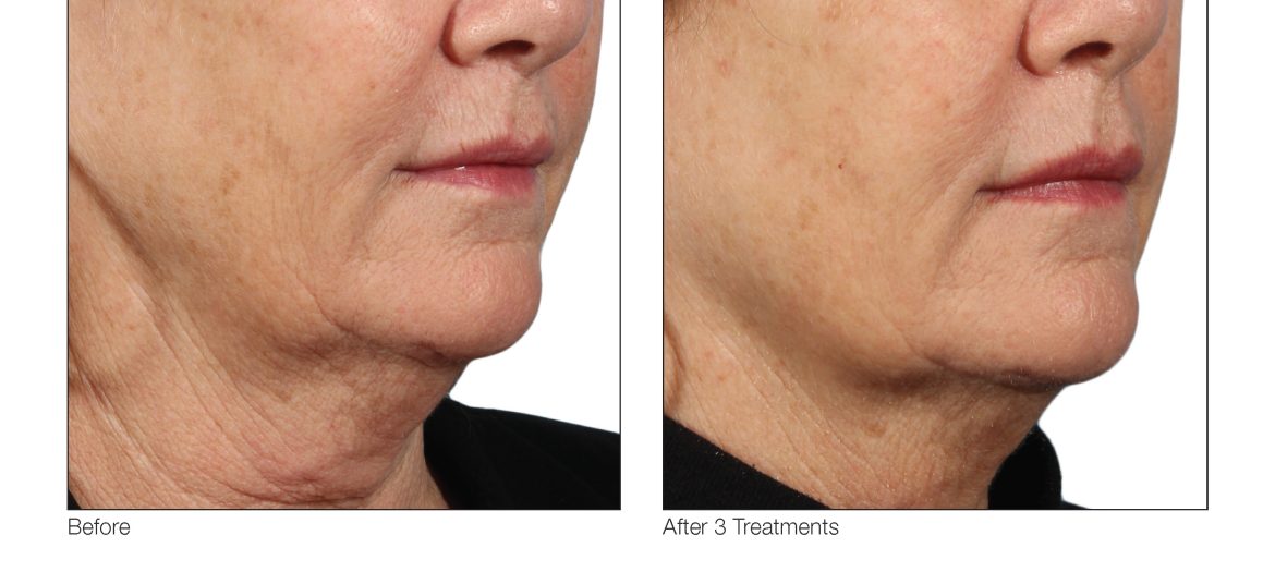 VenusViva_SuzanneYee_Face_3Tx_4