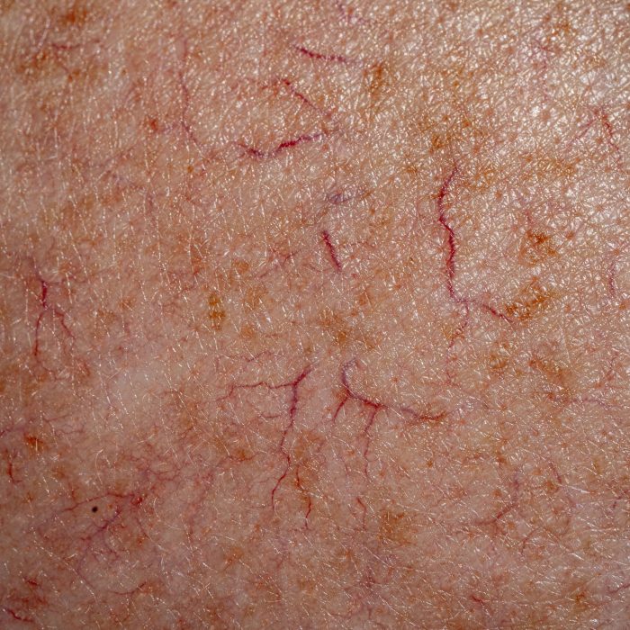 Macro shot of the human skin with veins.