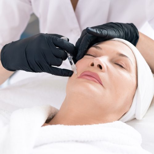 Removing wrinkles around mouth